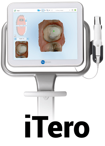 iTero Scanner Device